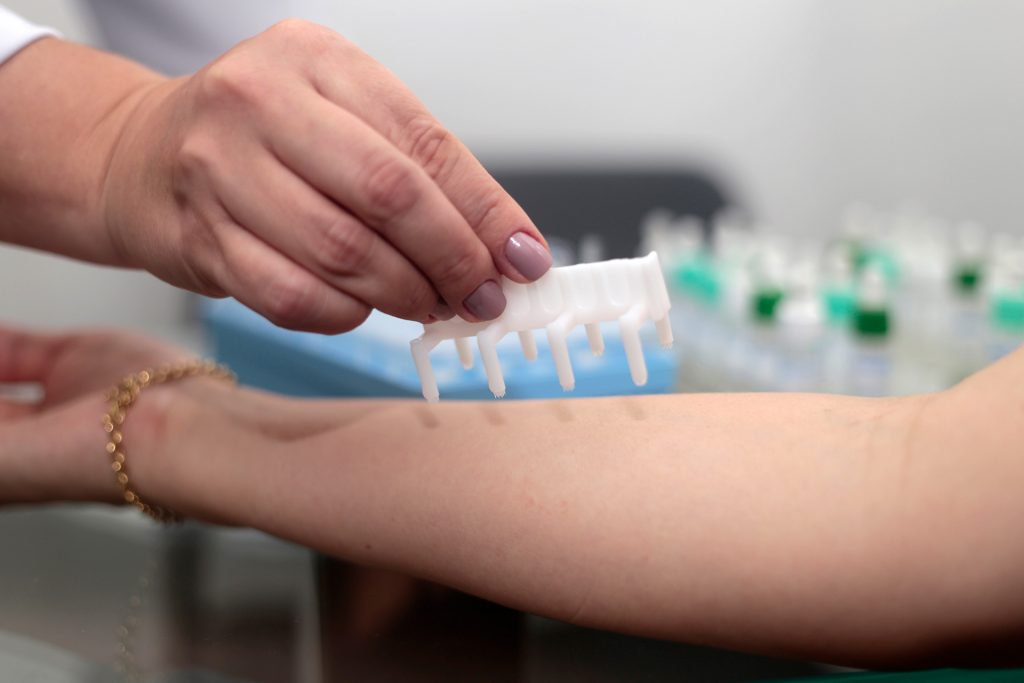 Prick test que causa menos dor do que outros testes alérgicos